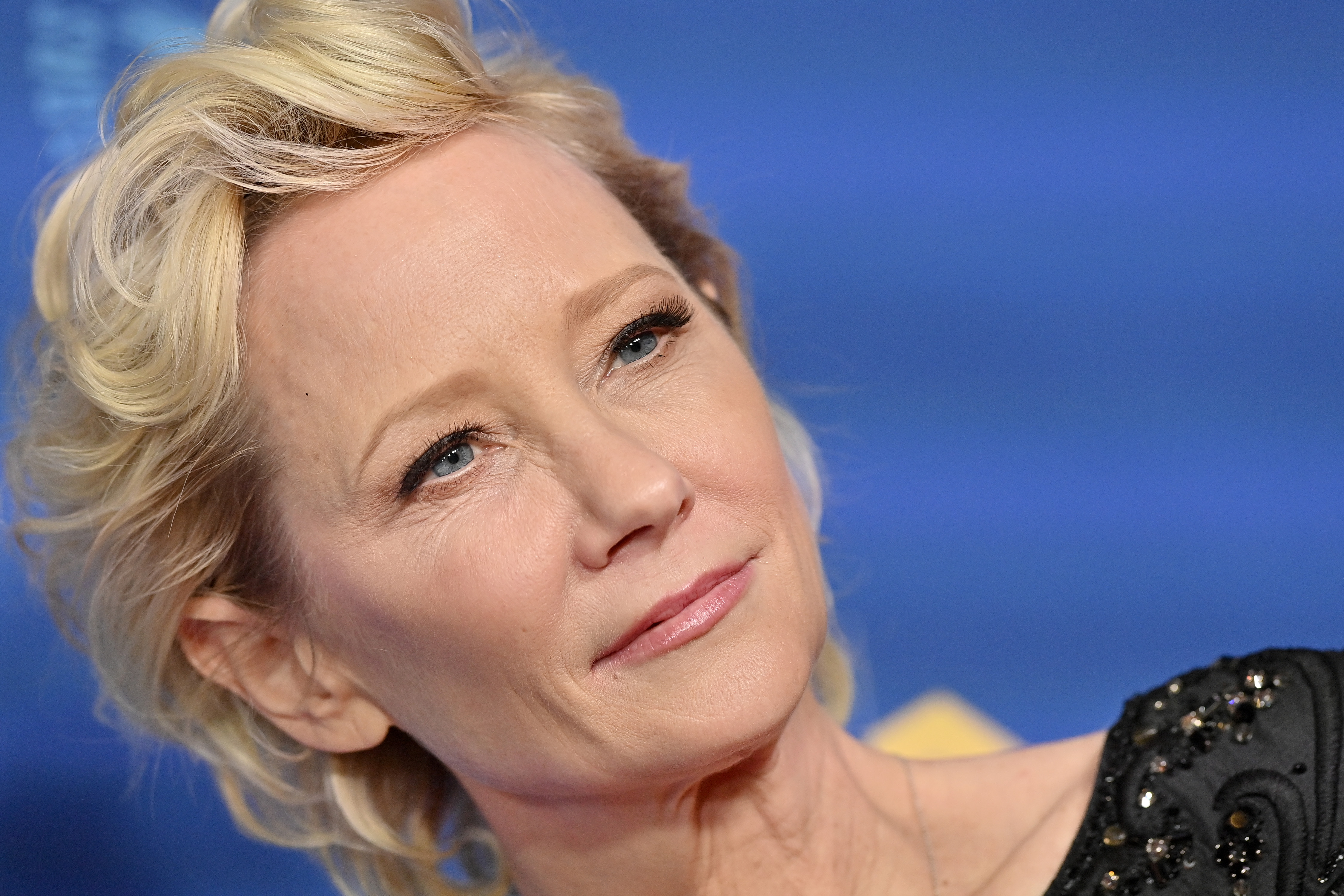 Hollywood Actor, Anne Heche still in coma after a car crash Anne Heche is in critical condition